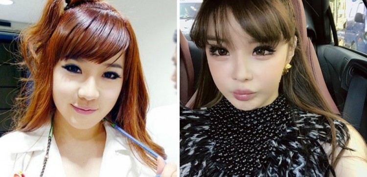 Park Bom Plastic Surgery 2018: Former 2NE1 Star Looks Unrecognizable In